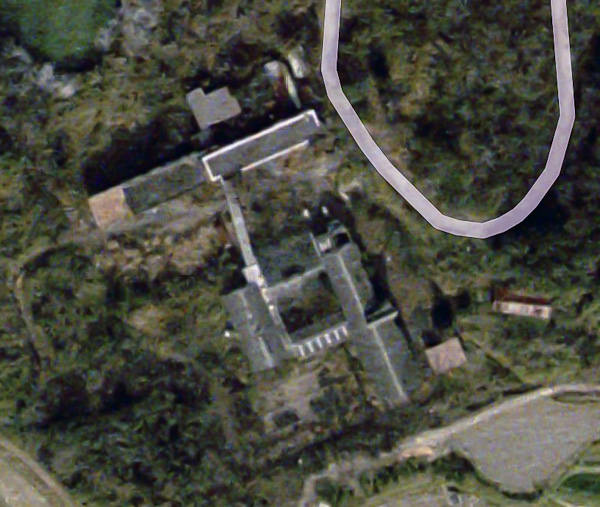 結核病棟　其の壱　プロローグ-2